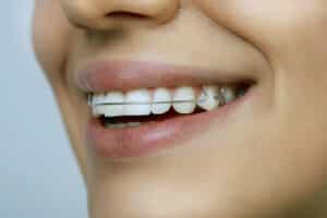 Essential Role of Retainers