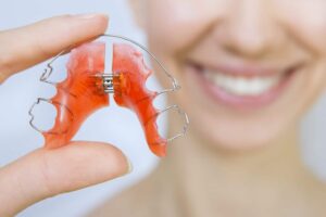 Essential Role of Retainers